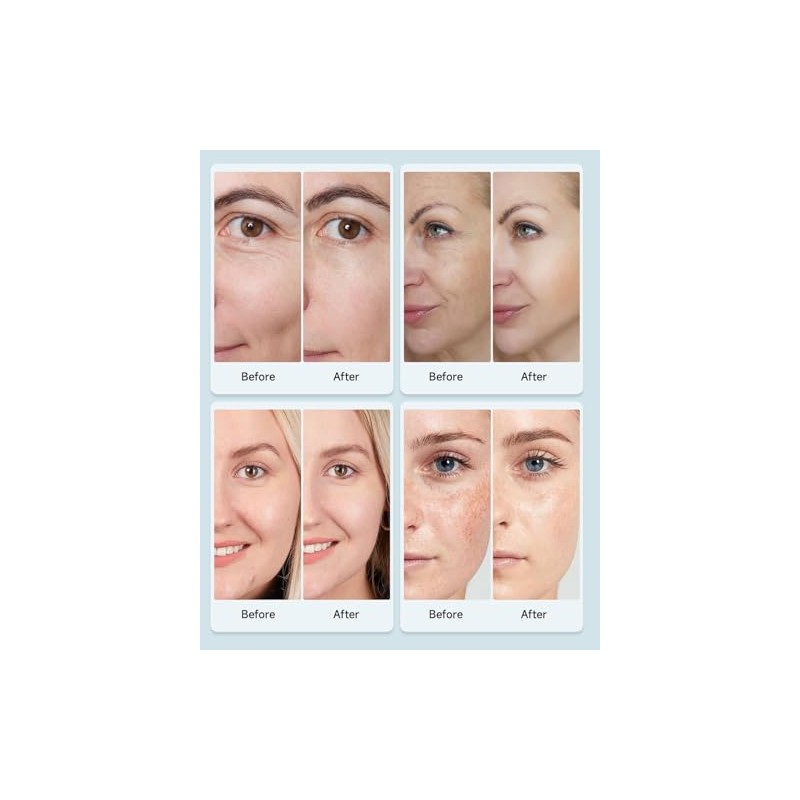 Beauty Led Mask, Led Face Mask Light Therapy