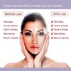 Nutriglow Platinum Diamond Gold and Pearl Facial Kit 6-Pieces Skin