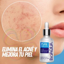 Universo en Linea Set De 3 Pure Skin Bioaqua Retira Acne Y Espinillas Grasa