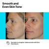 Ph Lab Zero Pore Skin and Pore Tightening Serum, Strengthens