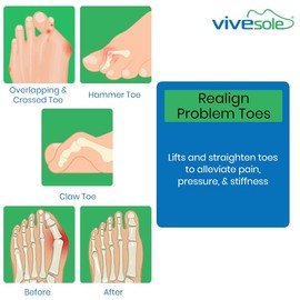 ViveSole Budin Splint Toe Straightener (Pair) - Hammer Toe Corrector for Women, Men - Crooked Toe, Joint Realign Cushion Brace for Claw, Curled - Metatarsal Support Loop Guard Alignment Corrector Wrap