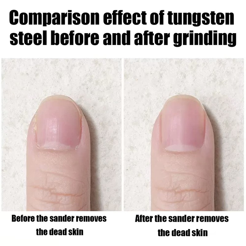 Alicer Bits for Electric Nail Cutters, Pack of 5 Tungsten