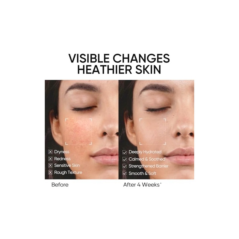 SKINTIFIC Crema hidratante facial con ceramidas 5X, 100 g