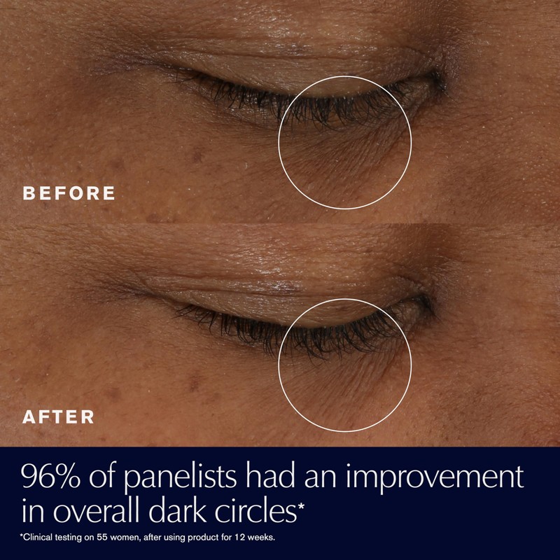 Estée Lauder Advanced Night Repair Eye Supercharged Gel-Cream Synchronized Multi-Recovery