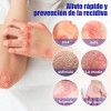 Crema De Tratamiento Psoriasis Para Picazón Y Escamosa