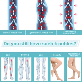 Thigh High 20-30 mmHg Compression Stocking Toeless Compression Socks for women & men circulation with Silicone Dot Band,Relieves muscle soreness