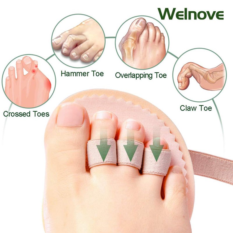 Welnove Toe Straightener Hammer Toes Corrector Pack of 2 (3