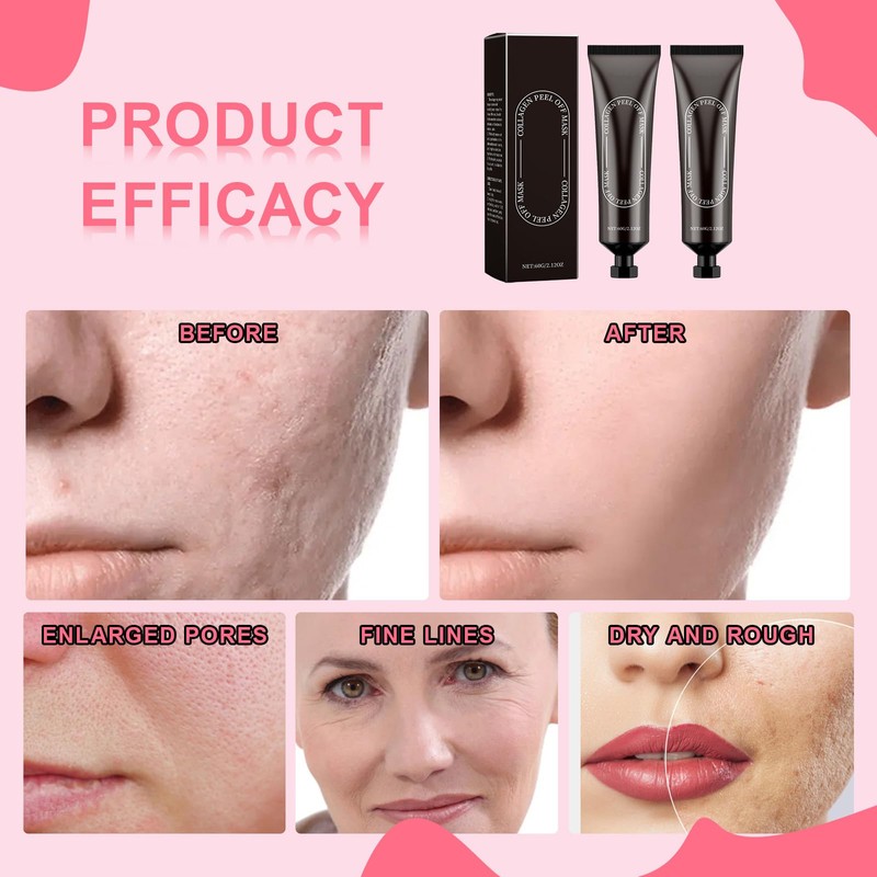 FunnAura 2PCS Collagen Face Masks, Face Peel off Mask, Hydrolyzed