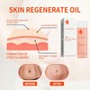 125ml Stretch Mark Oil & Scar Treatment, Skin Regeneration Oil
