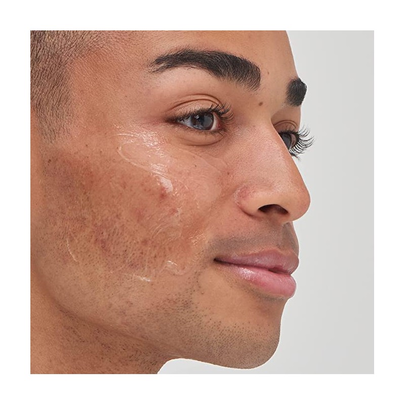 The INKEY List 2% Tranexamic Acid Serum to Reduce Hyperpigmentation