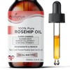 ORGANIC ROSEHIP OIL (100 ML)
