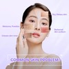 SEYOUL 21-Day Essence - Brightening Treatment, Spot Treatment, and Enlarged