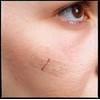 Nexcare Steri-Strip Skin Closures, Tan, 6 mm x 75 mm,