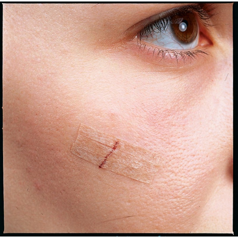 Nexcare Steri-Strip Skin Closures, Tan, 6 mm x 75 mm,