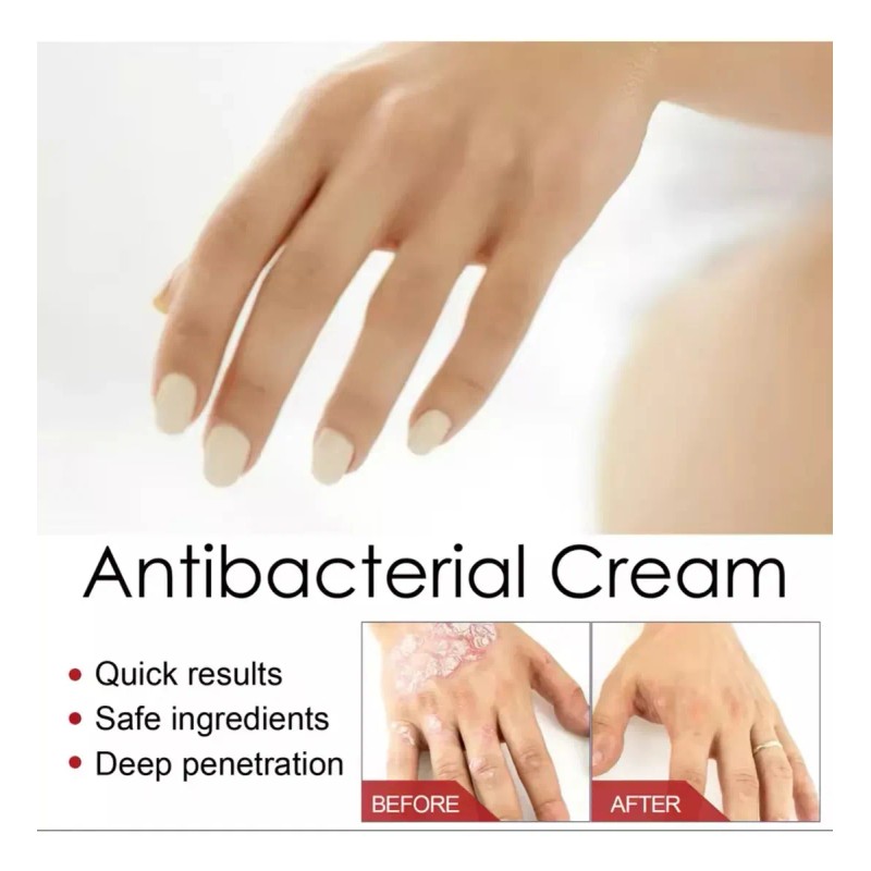Crema Antibacteriana Psoriasis Eczema Rash Rojo Dermastitis
