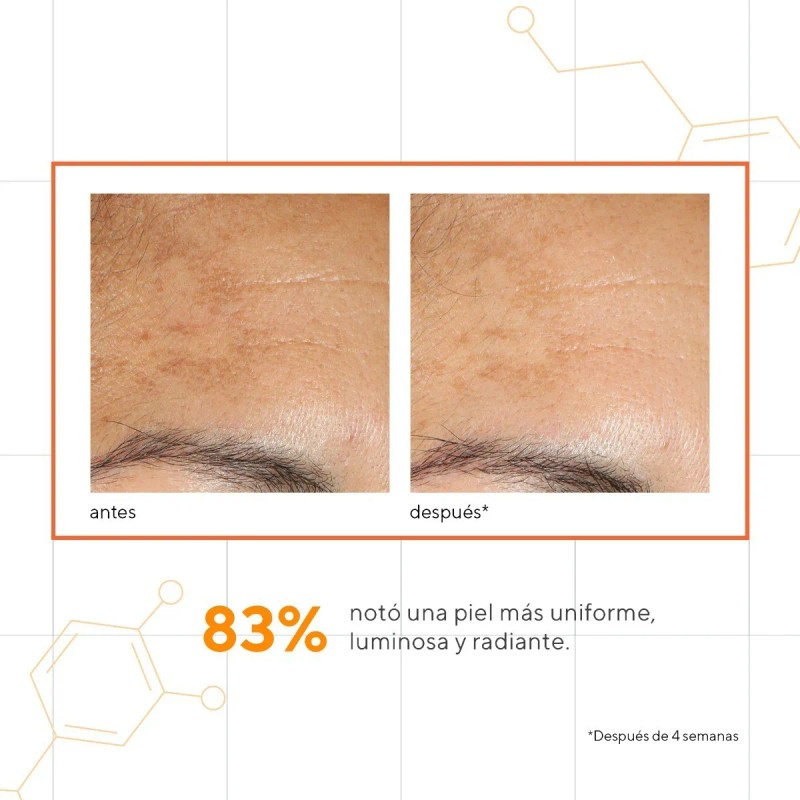 Murad Suero Facial Vitamina C Ácido Glicólico Antimanchas 30ml