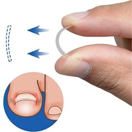 Young21 Ingrown Toenail Straightening Clip Curved Bs Brace Toenails Thick Paronychia Correction Tool