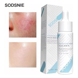 ✨ Sérum Intensivo para Piel Acneica: Reduce Enrojecimiento 🔴, Poros 👃 y Exceso de Grasa 💧