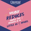 Clearasil Rapid Action Pimple Cream 15ml
