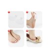 Gel Metatarsal Pads with Loop Forefoot Cushion (White, One Size)