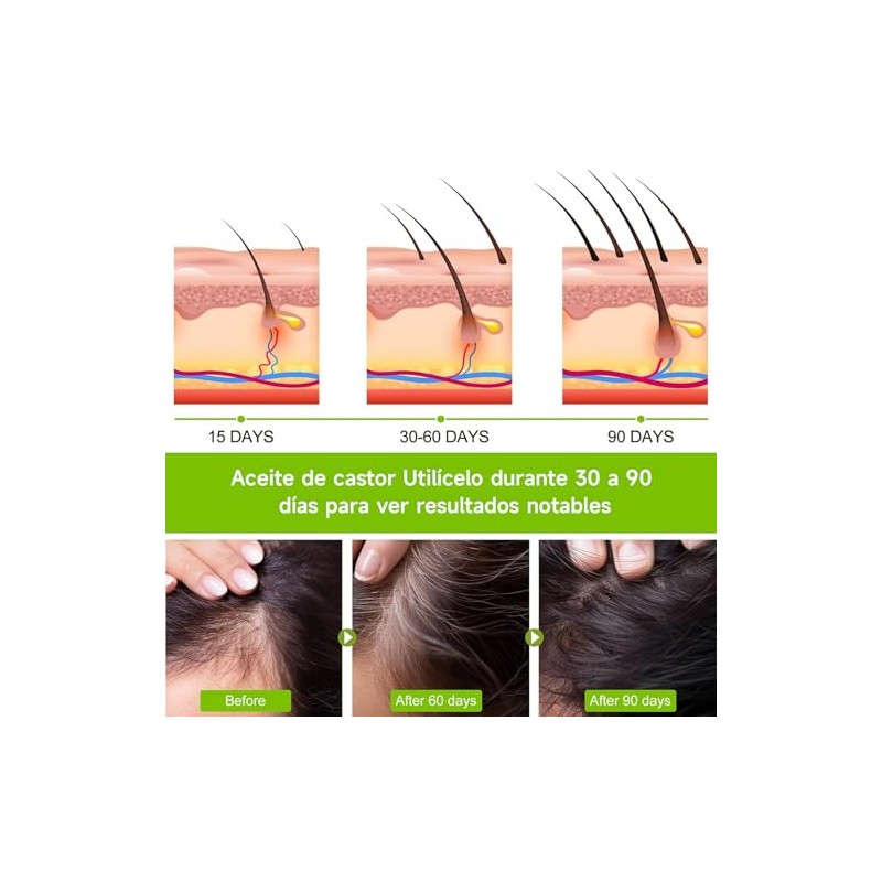 SADOWAY Aceite de Ricino Orgánico para Cabello Seco y Maltratado,