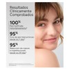 AZEANE ACIDO AZELAICO 15% CREMA 30ML, (ACM)