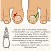 Toenail Clippers for Thick Nails Heavy Duty Cantilever Cutter Chiropodist