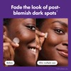 Mighty Patch Original - Micropoint for Dark Spots. Para Puntos