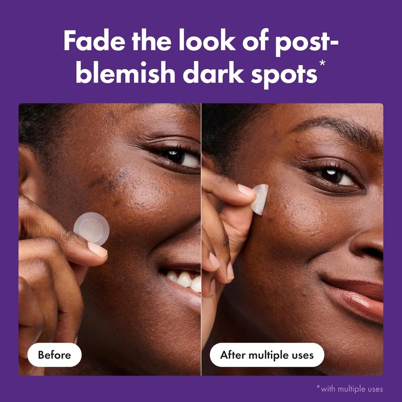 Mighty Patch Original - Micropoint for Dark Spots. Para Puntos