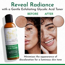 Tree To Tub Glycolic Acid Toner for Face w/Witch Hazel & Hydrating Aloe Vera for Smooth Skin - Minimizes Appearance of Fine Lines & Brightens - Vegan Exfoliating Toner for Women & Men