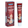 Xt ! Crema Anticongelante Anticongelante For Manos Y Pies /