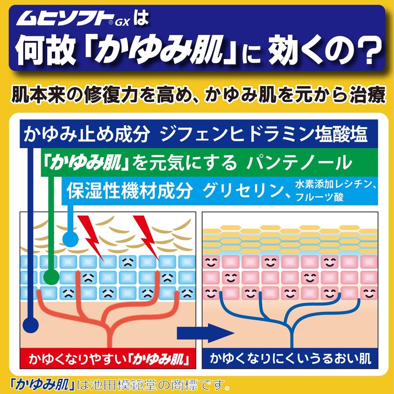 【第3類医薬品】かゆみ肌の治療薬 ムヒソフトGX乳状液 120mL
