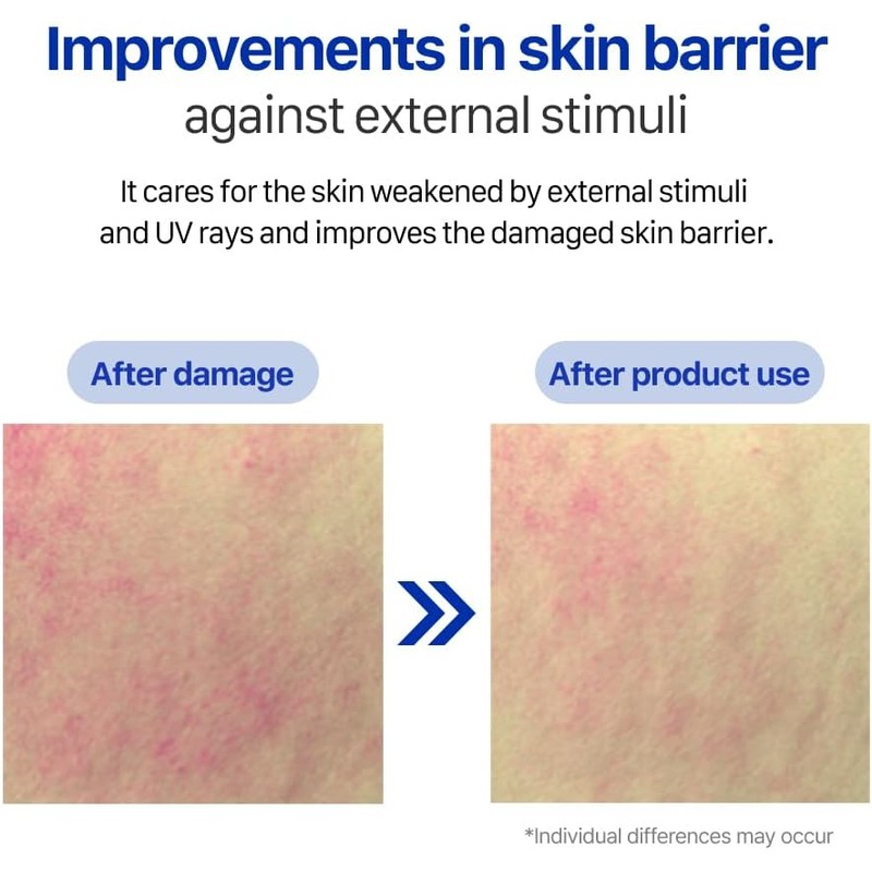 Atopalm Real Barrier Extreme Crema Máscara para todo tipo de