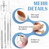 VEGCOO Ingrown Toenails Tool Set, with Ingrown Correction Sticker, Ingrown