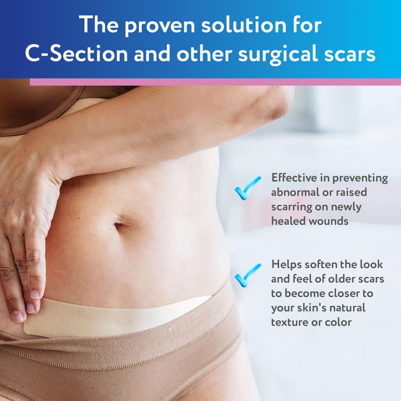 ScarAway Advanced Silicone Scar Sheets for C-Section, Reusable Strips (1.5”