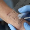 Geiserailie 4 Pcs Medical Ruler with Wound Measuring and Pupil