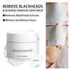 Blackhead Remover, Blackhead Remover Mask, Nosestripes Blackheads, Tear-Off Blackhead Strips,
