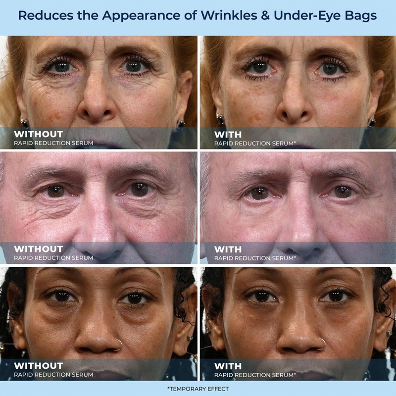 Plexa derm Rapid Reduction Wrinkle Serum - Reduces Under-Eye Bags,