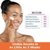 Palmer’s Skin Success Crema Anti-Manchas con Vitamina E y Niacinamida,