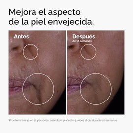 The Ordinary GF 15% Solution, Suero para signos de la edad — Fórmula para mejorar visiblemente las arrugas de la piel, 30ml