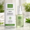 Martiderm Acniover Serum Momento de aplicación Día/Noche Tipo de piel