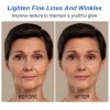 Kojic Sen Skin Lighthening Body Lotion Darkspots Brightens, 16oz [USA
