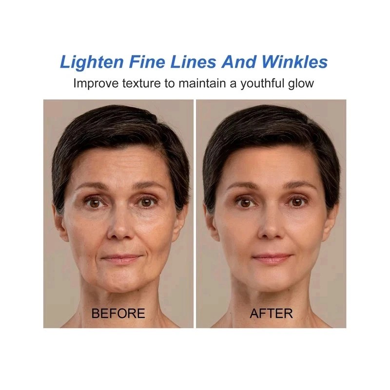 Kojic Sen Skin Lighthening Body Lotion Darkspots Brightens, 16oz [USA