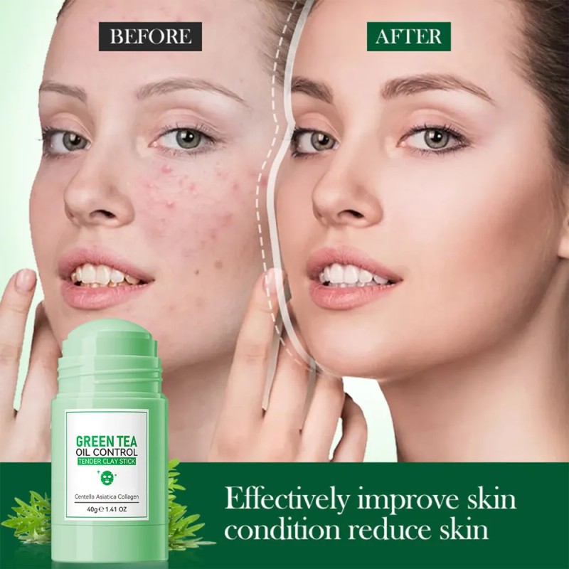 A Mascarilla De Barro Facial Limpiadora En Barra King Mud