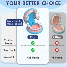 Lehoo Castle Doctor Kit for Toddlers 3-5, Kids Dentist Play Set, Toys for 4+ Year Old Girls Boys, Pretend Play for Toddlers 2-4, Kids Doctor Playset, Medical Kits for Boys 3+