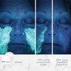 Nasif MD exfoliation pad |Deep Cleansing Surgeon-Crafted AHABHA Facial for