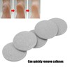Pack of 5 Extra Coarse Callus Remover Hard Skin Replacement