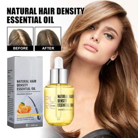 Hair Growth Serum Anti Hair Loss Hair Serum Ginger Regrowth Hair Oil For Thinning Balding,Thin Hair,Fast Growth,Repairs Follicles Stronger Hair For Men & Women,35ml (1pc)