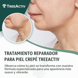 TreeActiv Crepey Skin Repair Treatment | Anti-Aging | Anti-Wrinkle | Organic Ingredients for Face, Neck, Chest, Legs & Arms | Hyaluronic Acid, Alpha H