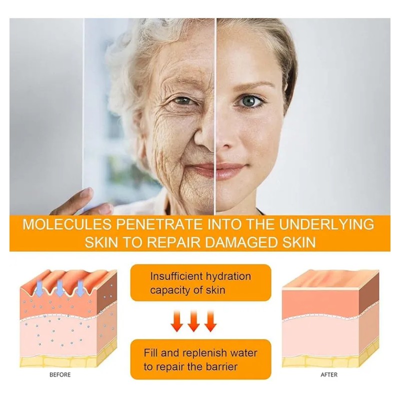 Crema Para Ojos, Gel Antiarrugas Y Reafirmante Para Ojeras